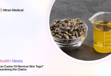 Can Castor Oil Remove Skin Tags