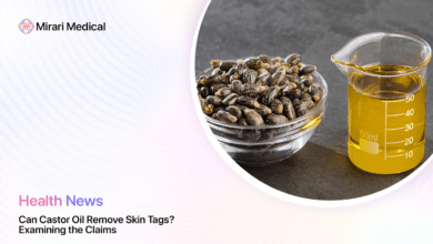 Can Castor Oil Remove Skin Tags