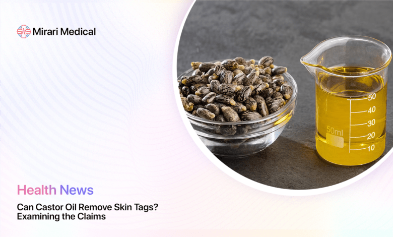 Can Castor Oil Remove Skin Tags