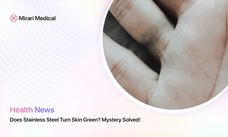 Does Stainless Steel Turn Skin Green