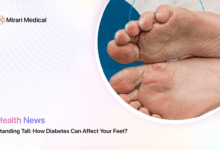 How Diabetes Affects Feet