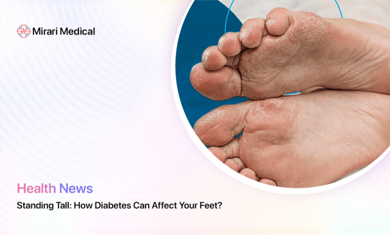 How Diabetes Affects Feet