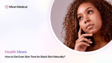 How To Get Even Skin Tone For Black Skin Naturally