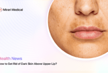 How To Get Rid Of Dark Skin Above Upper Lip