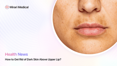 How To Get Rid Of Dark Skin Above Upper Lip