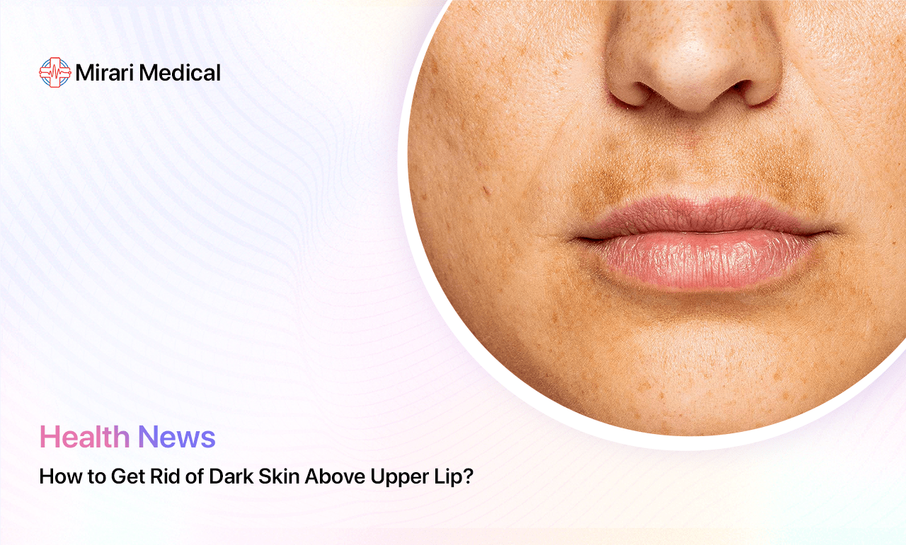 How To Get Rid Of Dark Skin Above Upper Lip