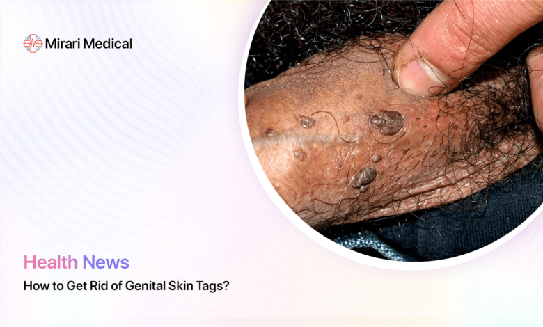 How To Get Rid Of Genital Skin Tags