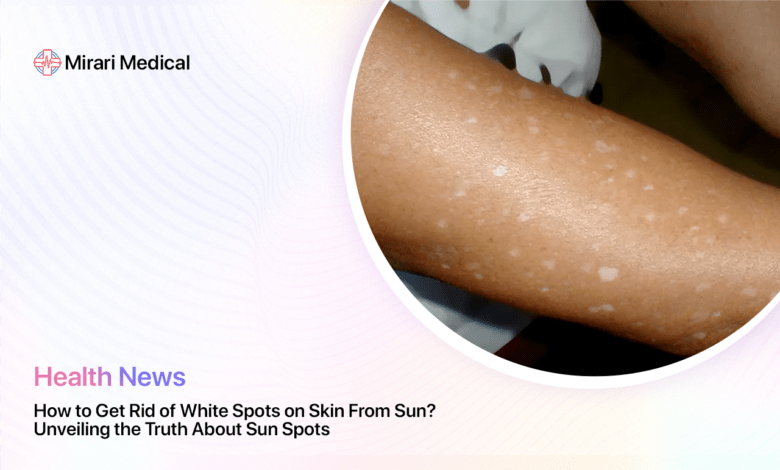 How To Get Rid Of White Spots On Skin From Sun