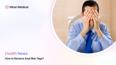 How To Remove Anal Skin Tags