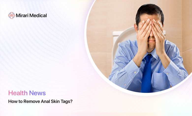 How To Remove Anal Skin Tags