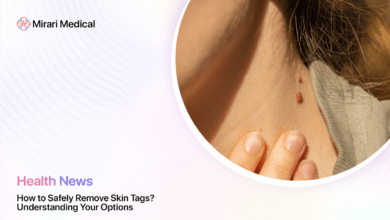 How To Safely Remove Skin Tags