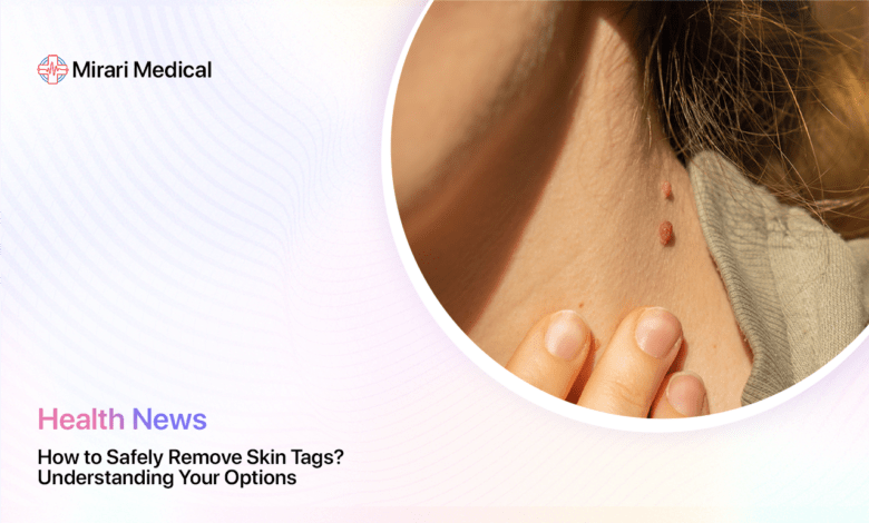 How To Safely Remove Skin Tags