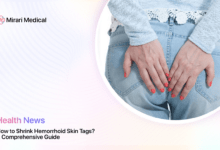 How To Shrink Hemorrhoid Skin Tag