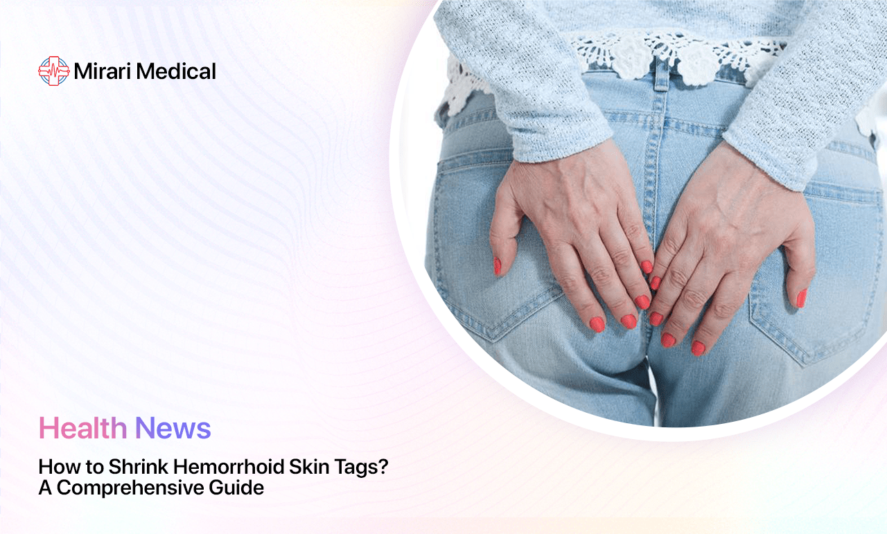 How to Shrink Hemorrhoid Skin Tags: A Comprehensive Guide