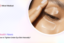 How To Tighten Under Eye Skin Naturally