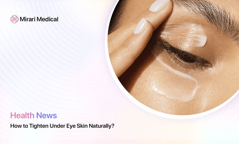 How To Tighten Under Eye Skin Naturally