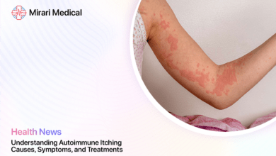 Autoimmune Itching