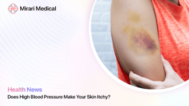 Does High Blood Pressure Make Your Skin Itchy