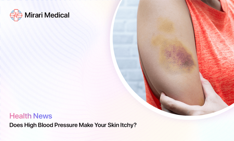 Does High Blood Pressure Make Your Skin Itchy