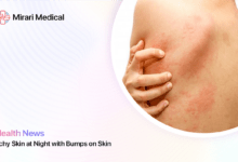 Itchy Skin At Night With Bumps On Skin