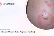 Red Spots On Stomach During Pregnancy Not Itchy