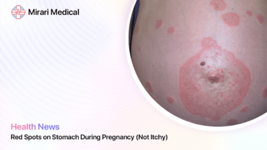 Red Spots On Stomach During Pregnancy Not Itchy