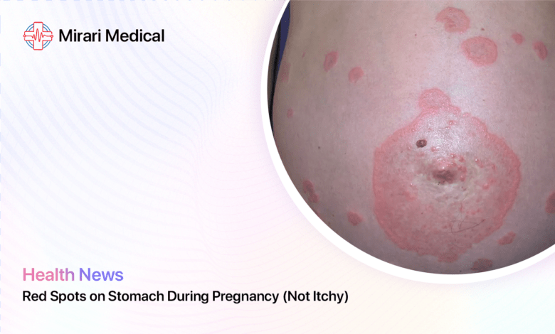 Red Spots On Stomach During Pregnancy Not Itchy