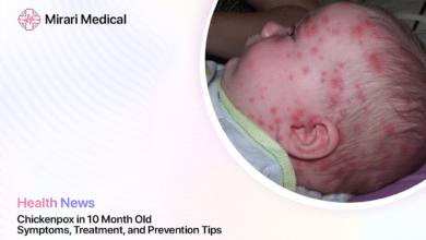 Chickenpox In 10 Month Old