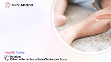 Home Remedies For Chickenpox Scars