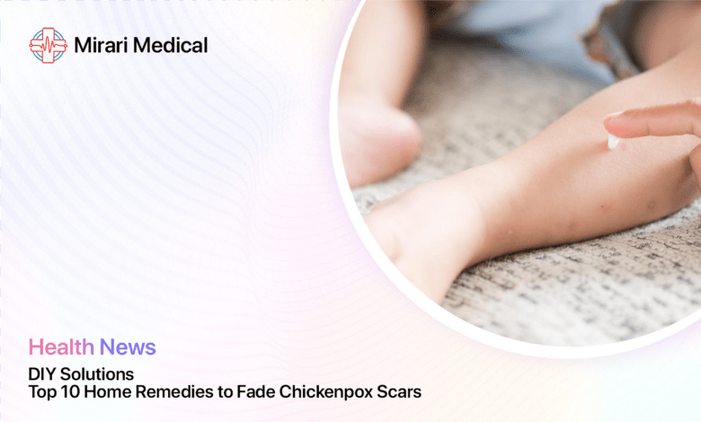 Home Remedies For Chickenpox Scars