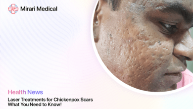 Laser Treatment For Chickenpox Scars