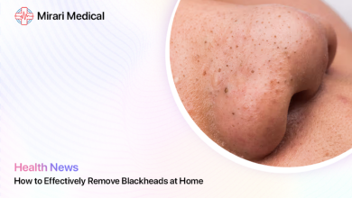 Blackhead Removal