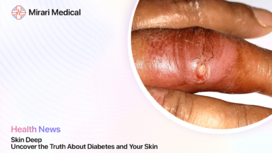 Diabetes And Skin Health