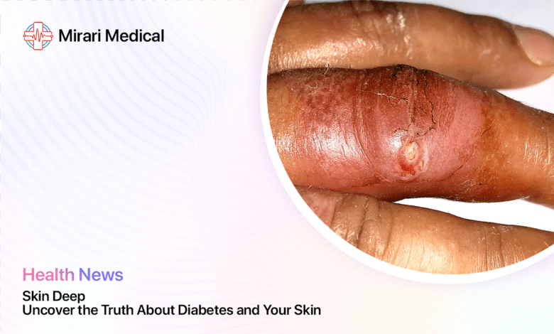 Diabetes And Skin Health