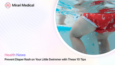 Diaper Rash And Swimming