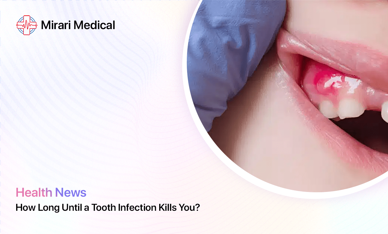 How Long Until A Tooth Infection Kills You