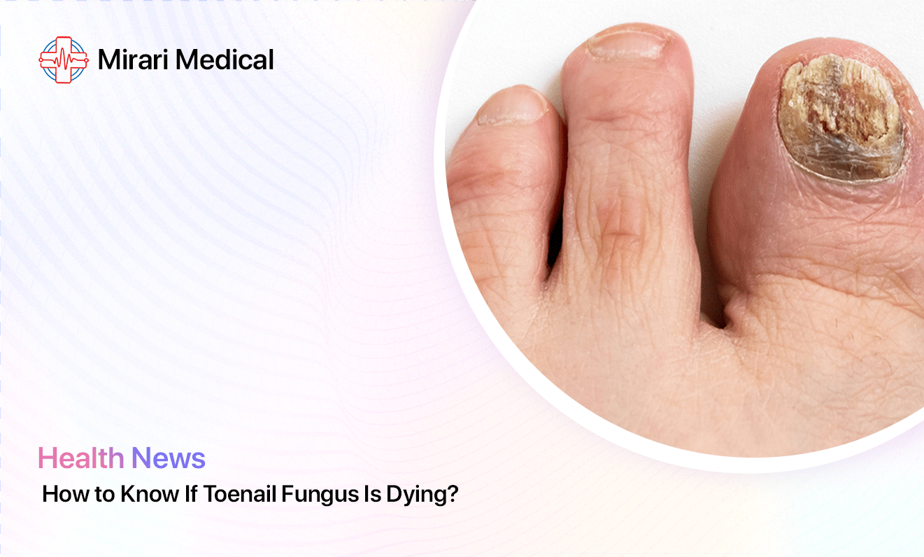 How To Know If Toenail Fungus Is Dying